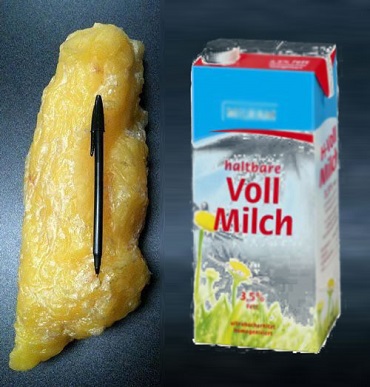 Wie funktioniert Fettabbau? - 7.000kcal = 1kg Körperfett = 1 Liter Milch (von Benjamin Erhardt)